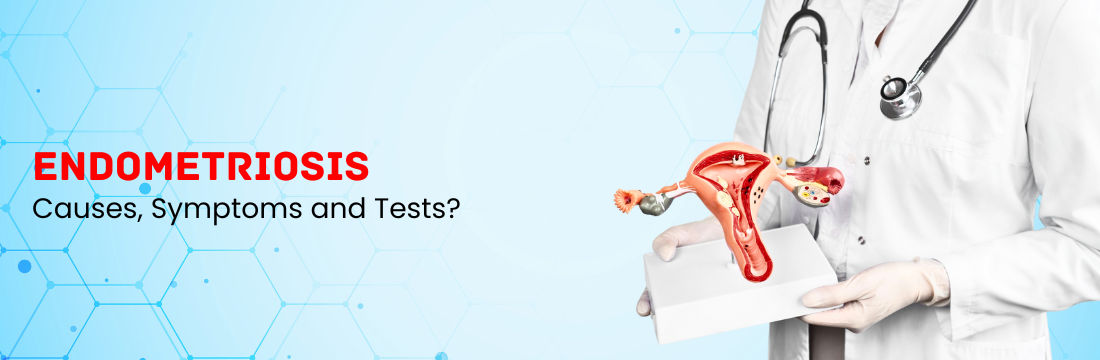 Guide to Endometriosis: What are the Causes, Symptoms, and Tests?